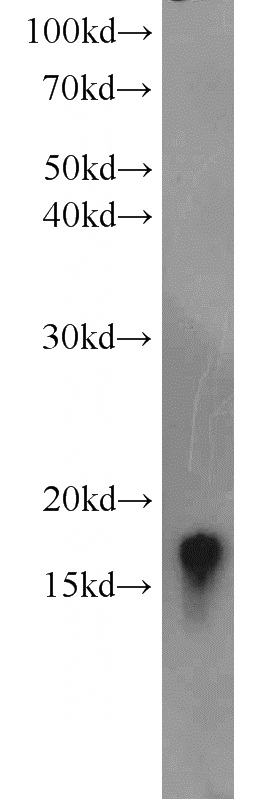 HEK-293 cells were subjected to SDS PAGE followed by western blot with Catalog No:116706(VAMP3 antibody) at dilution of 1:1000