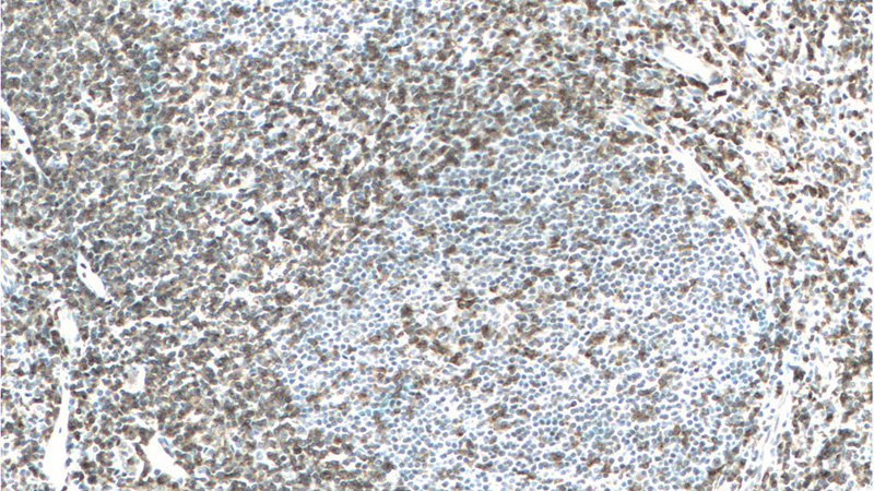 Immunohistochemistry of paraffin-embedded human tonsillitis tissue slide using Catalog No:109064(CD2 Antibody) at dilution of 1:200 (under 10x lens). Heat mediated antigen retrieved with Tris-EDTA buffer, pH9.0