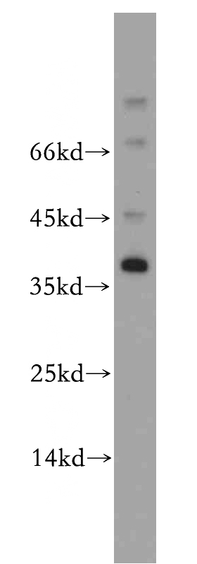 mouse testis tissue were subjected to SDS PAGE followed by western blot with Catalog No:107943(AKR1CL2 antibody) at dilution of 1:500