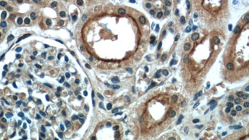 Immunohistochemical of paraffin-embedded human kidney using Catalog No:113659(PDE2A antibody) at dilution of 1:50 (under 40x lens)