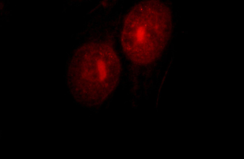 Immunofluorescent analysis of HepG2 cells, using UBE2E2 antibody Catalog No:116522 at 1:25 dilution and Rhodamine-labeled goat anti-rabbit IgG (red).