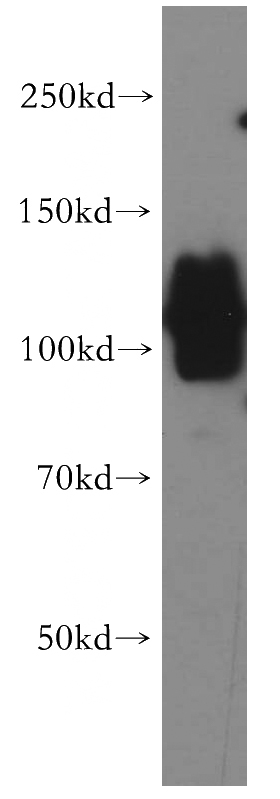 human brain tissue were subjected to SDS PAGE followed by western blot with Catalog No:110406(ERC2 antibody) at dilution of 1:500