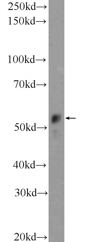 HeLa cells were subjected to SDS PAGE followed by western blot with Catalog No:111915(KATNAL1 Antibody) at dilution of 1:300