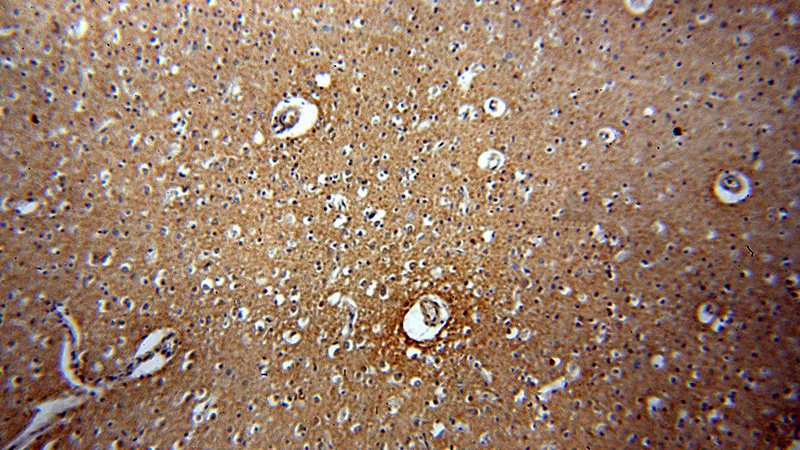 Immunohistochemical of paraffin-embedded human brain using Catalog No:115300(SLC12A5-Specific antibody) at dilution of 1:100 (under 10x lens)