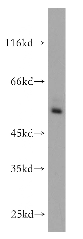 HEK-293 cells were subjected to SDS PAGE followed by western blot with Catalog No:114790(RORC antibody) at dilution of 1:200