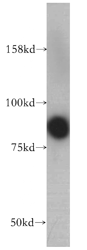 NIH/3T3 cells were subjected to SDS PAGE followed by western blot with Catalog No:113003(MYST2 antibody) at dilution of 1:500