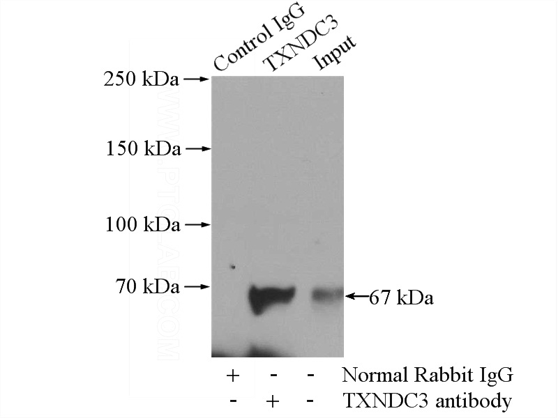 IP Result of anti-TXNDC3 (IP:Catalog No:116450, 4ug; Detection:Catalog No:116450 1:1000) with mouse testis tissue lysate 4000ug.