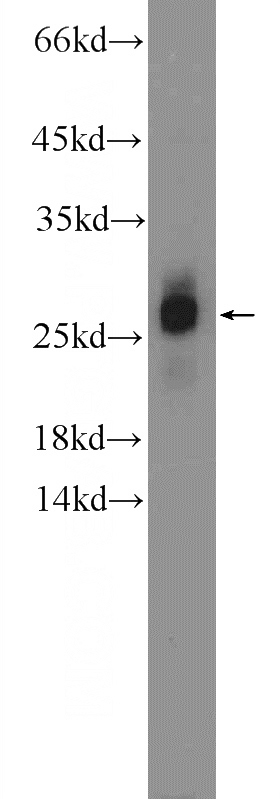 mouse brain tissue were subjected to SDS PAGE followed by western blot with Catalog No:117028(ZNF740 Antibody) at dilution of 1:600