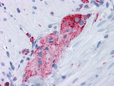 Immunohistochemical analysis of paraffin-embedded human Small Intestine, myenteric plexus tissues using anti-SYP mouse mAb