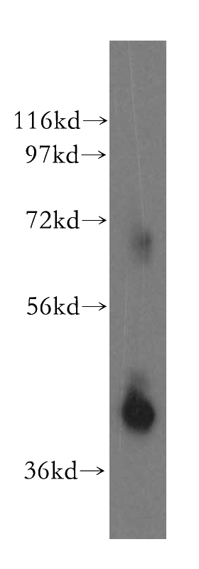 human brain tissue were subjected to SDS PAGE followed by western blot with Catalog No:112017(KCTD12 antibody) at dilution of 1:500