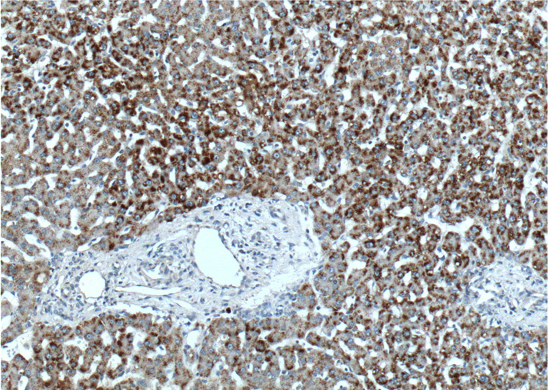 Immunohistochemistry of paraffin-embedded human liver tissue slide using Catalog No:115847(TAOK1 Antibody) at dilution of 1:200 (under 10x lens).