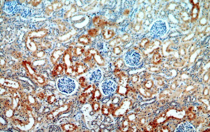 Immunohistochemical of paraffin-embedded human kidney using Catalog No:114293(PSAT1 antibody) at dilution of 1:100 (under 10x lens)