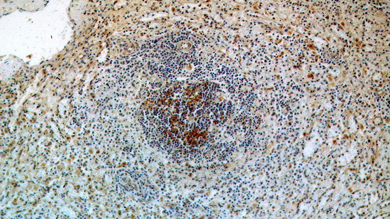 Immunohistochemical of paraffin-embedded human spleen using Catalog No:113201(NKTR antibody) at dilution of 1:100 (under 10x lens)