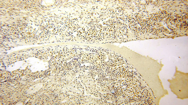 Immunohistochemical of paraffin-embedded human ovary using Catalog No:114035(POLR1C antibody) at dilution of 1:200 (under 10x lens)