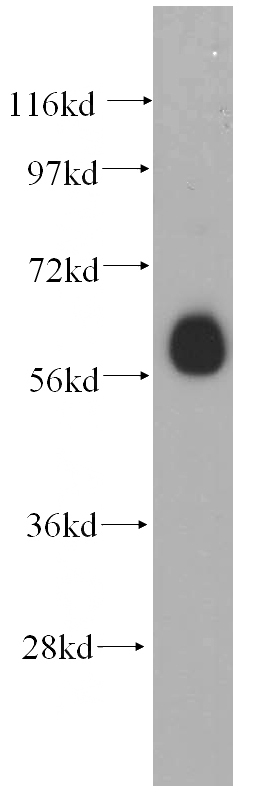 HEK-293 cells were subjected to SDS PAGE followed by western blot with Catalog No:108193(ARIH2 antibody) at dilution of 1:500