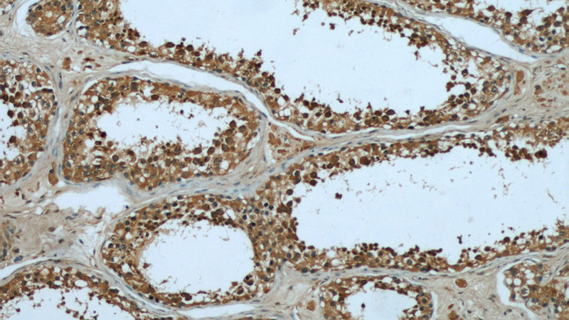 Immunohistochemical of paraffin-embedded human testis using Catalog No:112040(KHSRP antibody) at dilution of 1:50 (under 10x lens)