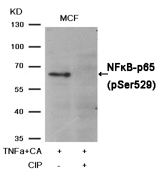 Western blot analysis of extracts from MCF cells, treated with TNFa+CA or calf intestinal phosphatase (CIP), using NFu03baB-p65 (Phospho-Ser529) Antibody .