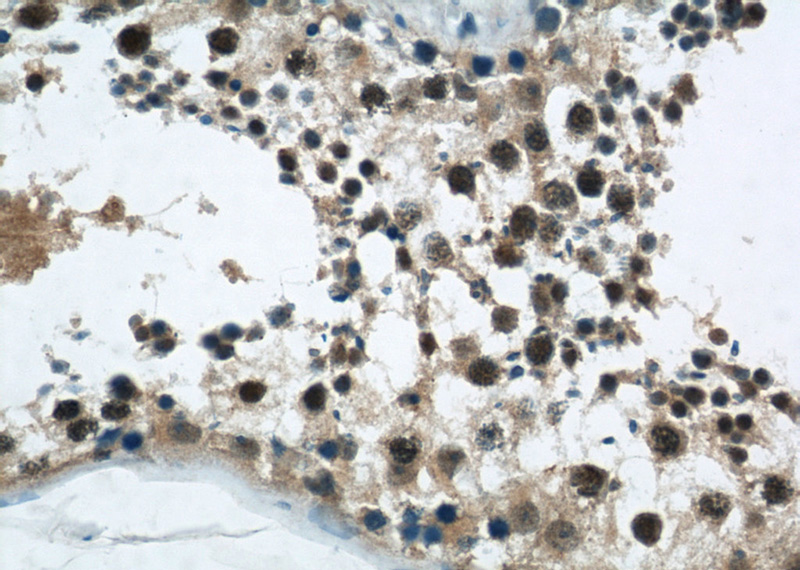 Immunohistochemical of paraffin-embedded human testis using Catalog No:114575(RCC1 antibody) at dilution of 1:50 (under 40x lens)