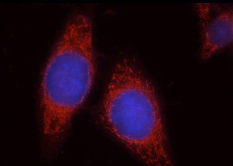 Immunofluorescent analysis of HepG2 cells using Catalog No:116576(Uroguanylin Antibody) at dilution of 1:50 and and Rhodamine-labeled goat anti-rabbit IgG (red).