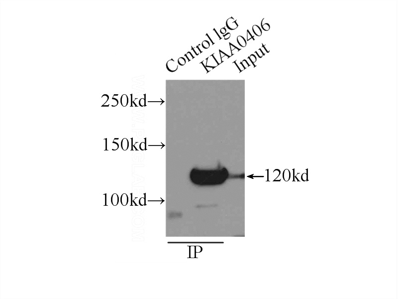 IP Result of anti-KIAA0406 (IP:Catalog No:116478, 4ug; Detection:Catalog No:116478 1:1000) with HeLa cells lysate 1600ug.