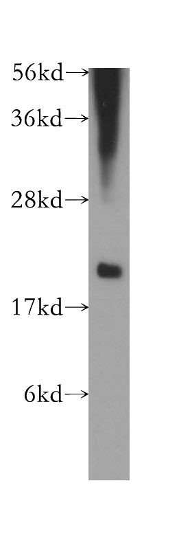 HL-60 cells were subjected to SDS PAGE followed by western blot with Catalog No:109716(CST7 antibody) at dilution of 1:500