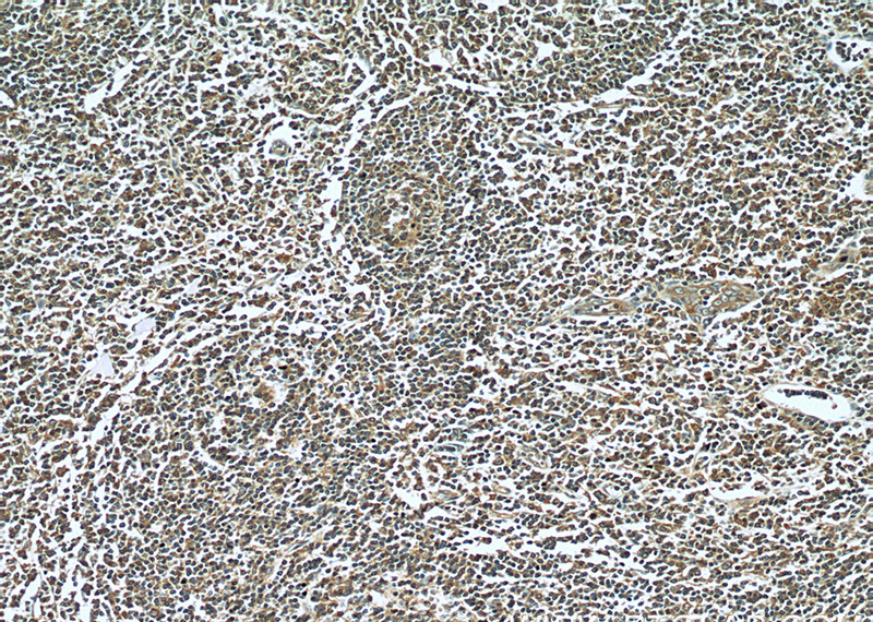 Immunohistochemistry of paraffin-embedded human tonsillitis tissue slide using Catalog No:112399(LY6E Antibody) at dilution of 1:50 (under 10x lens)