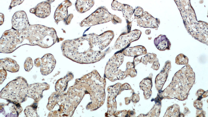Immunohistochemical of paraffin-embedded human placenta using Catalog No:111045(GOLPH3 antibody) at dilution of 1:100 (under 10x lens)