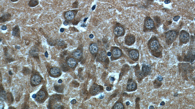 Immunohistochemical of paraffin-embedded rat brain using Catalog No:109209(CHAT antibody) at dilution of 1:50 (under 40x lens)