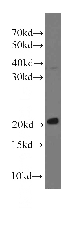 K-562 cells were subjected to SDS PAGE followed by western blot with Catalog No:107639(TAGLN2 antibody) at dilution of 1:1000