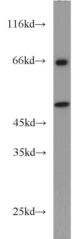 PC-3 cells were subjected to SDS PAGE followed by western blot with Catalog No:114686(RELT antibody) at dilution of 1:1000