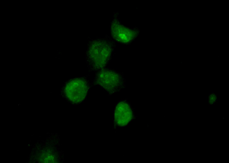 Immunofluorescent analysis of (10% Formaldehyde) fixed A431 cells using Catalog No:114581(RCOR3 Antibody) at dilution of 1:50 and Alexa Fluor 488-congugated AffiniPure Goat Anti-Rabbit IgG(H+L)