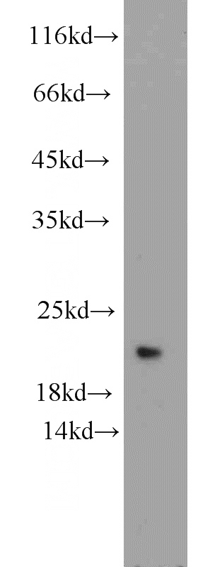 mouse pancreas tissue were subjected to SDS PAGE followed by western blot with Catalog No:116550(UFC1 antibody) at dilution of 1:1000