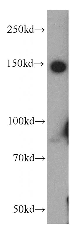 K-562 cells were subjected to SDS PAGE followed by western blot with Catalog No:114328(PTPRJ antibody) at dilution of 1:500