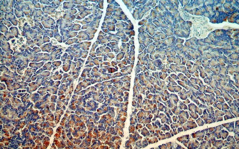 Immunohistochemical of paraffin-embedded human pancreas using Catalog No:109306(CTRL antibody) at dilution of 1:100 (under 10x lens)