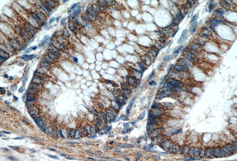 Immunohistochemistry of paraffin-embedded human colon tissue slide using Catalog No:113112(NELL1 Antibody) at dilution of 1:50 (under 40x lens)