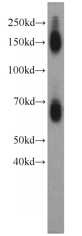 mouse brain tissue were subjected to SDS PAGE followed by western blot with Catalog No:110158(SLC1A2 antibody) at dilution of 1:1000