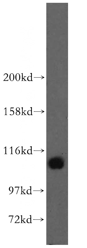 NIH/3T3 cells were subjected to SDS PAGE followed by western blot with Catalog No:115696(STAT6 antibody) at dilution of 1:1500