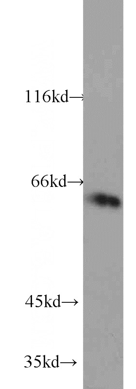 mouse skeletal muscle tissue were subjected to SDS PAGE followed by western blot with Catalog No:109706(CYP4F11-Specific antibody) at dilution of 1:600