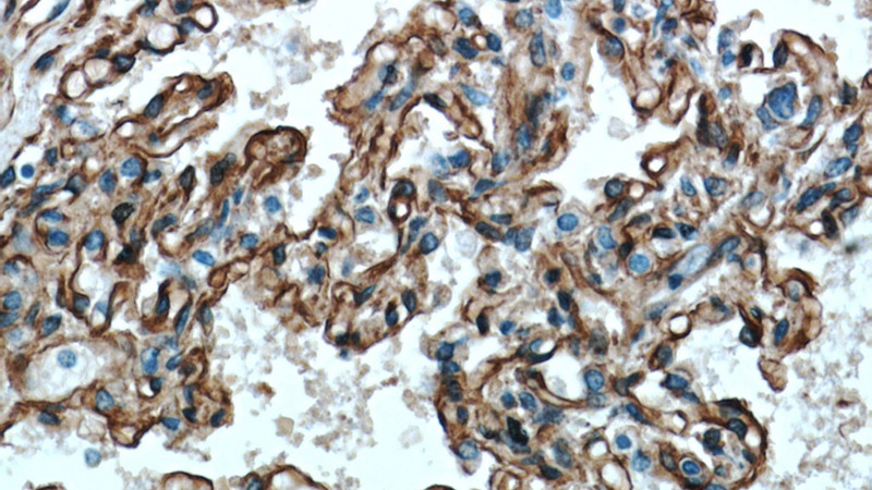 Immunohistochemical of paraffin-embedded human lung using Catalog No:108895(CAV1 antibody) at dilution of 1:50 (under 40x lens)