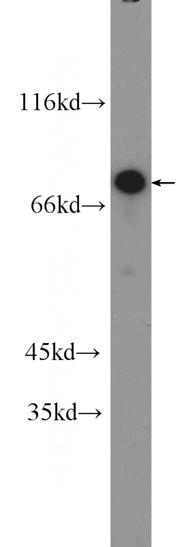Jurkat cells were subjected to SDS PAGE followed by western blot with Catalog No:117162(ZNF326 Antibody) at dilution of 1:600