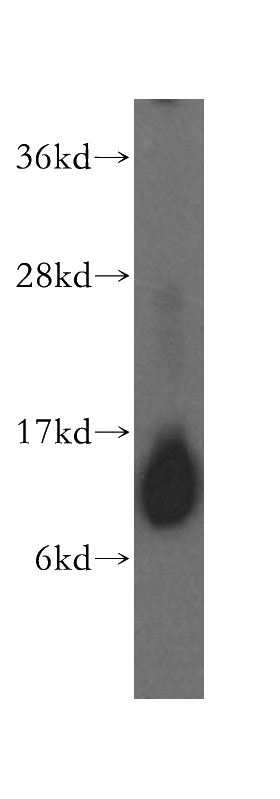 human kidney tissue were subjected to SDS PAGE followed by western blot with Catalog No:111757(IMMP2L antibody) at dilution of 1:500