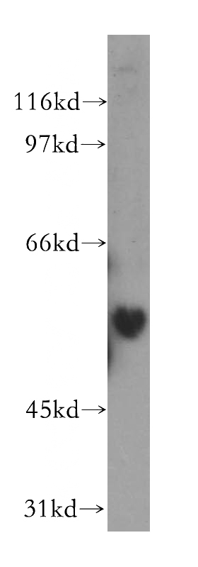 HepG2 cells were subjected to SDS PAGE followed by western blot with Catalog No:112038(KHDRBS3 antibody) at dilution of 1:300