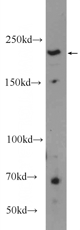 HeLa cells were subjected to SDS PAGE followed by western blot with Catalog No:110890(GBF1 Antibody) at dilution of 1:600