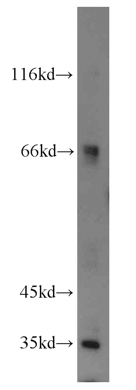 MCF7 cells were subjected to SDS PAGE followed by western blot with Catalog No:112884(MTX1 antibody) at dilution of 1:1000