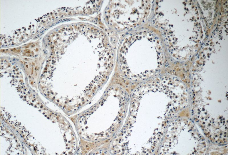 Immunohistochemistry of paraffin-embedded human testis tissue slide using Catalog No:112586(MED19 Antibody) at dilution of 1:50 (under 10x lens)