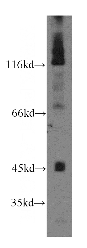 mouse skeletal muscle tissue were subjected to SDS PAGE followed by western blot with Catalog No:107860(ALLC antibody) at dilution of 1:500