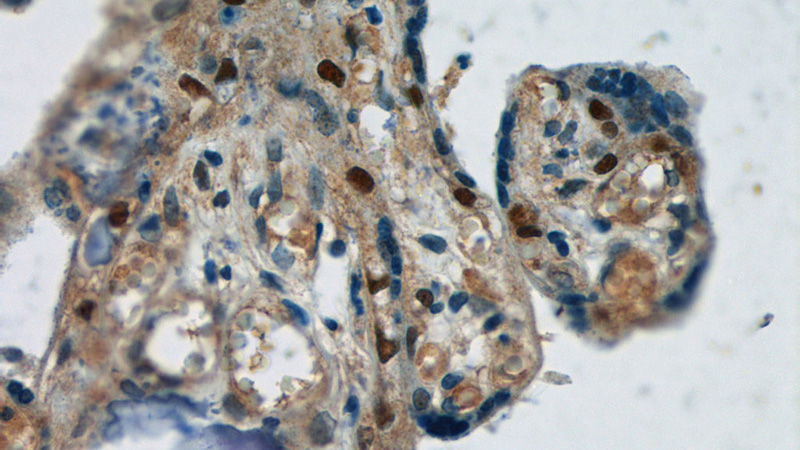 Immunohistochemistry of paraffin-embedded human placenta tissue slide using Catalog No:112552(MCM2 Antibody) at dilution of 1:50 (under 40x lens)