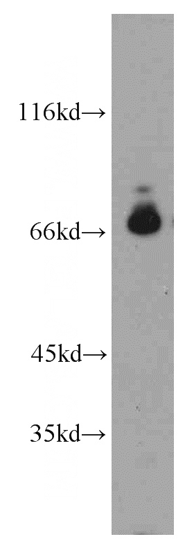 HeLa cells were subjected to SDS PAGE followed by western blot with Catalog No:113996(POLA2 antibody) at dilution of 1:500