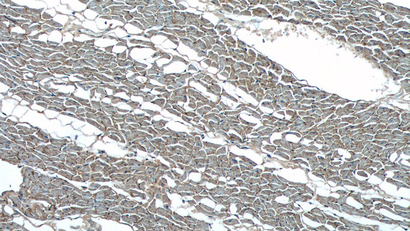 Immunohistochemistry of paraffin-embedded human heart tissue slide using Catalog No:113345(OLR1 Antibody) at dilution of 1:200 (under 10x lens).