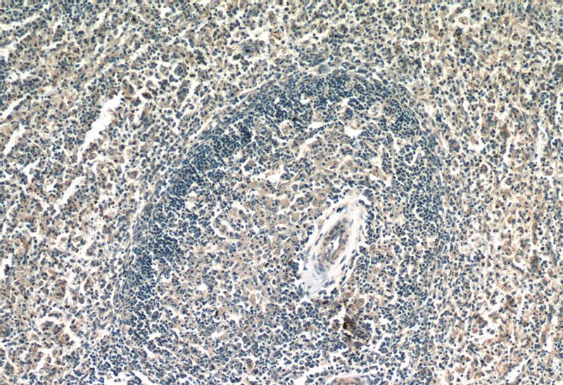 Immunohistochemistry of paraffin-embedded human spleen tissue slide using Catalog No:107687(ACOXL Antibody) at dilution of 1:50 (under 10x lens)